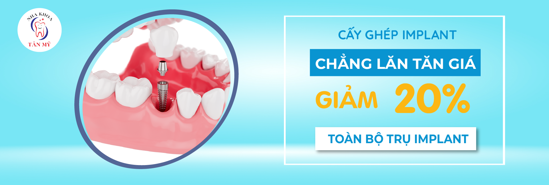 Implant nha khoa tân mỹ