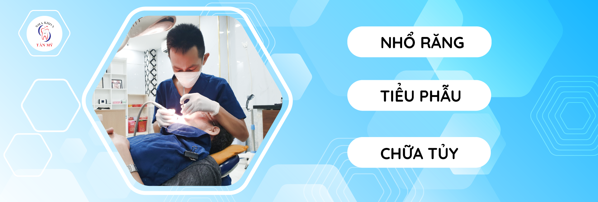 Nhổ răng Nha Khoa Tân Mỹ
